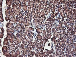 AKT1 Antibody (clone OTI4C11)