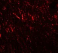 IHC-plus™ PRICKLE2 Antibody