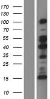 MAP2 Protein (Over-Expression Lysate Myc-DDK (Flag))