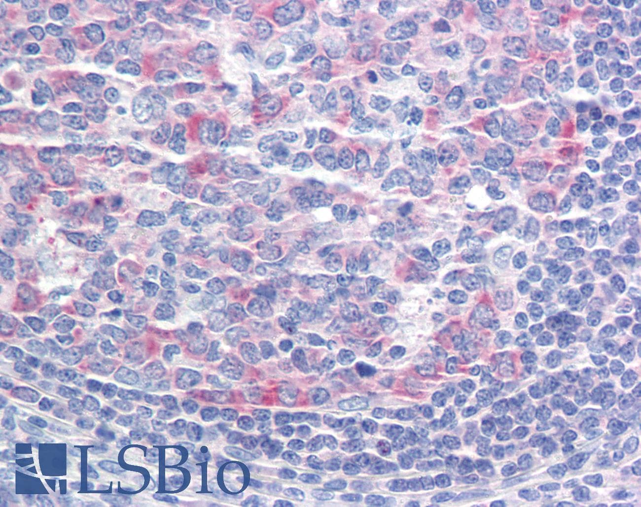 IHC-plus™ Polyclonal Goat anti-Human CCT3 Antibody (aa557-570, IHC, WB)