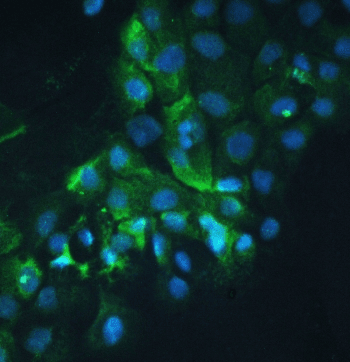 Polyclonal Rabbit anti-Human CTTN / Cortactin Antibody (IHC, IF, WB)