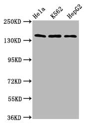 SF3B1 Antibody