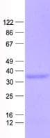 Human CLTA / LCA Protein (Recombinant His, N-Terminal)