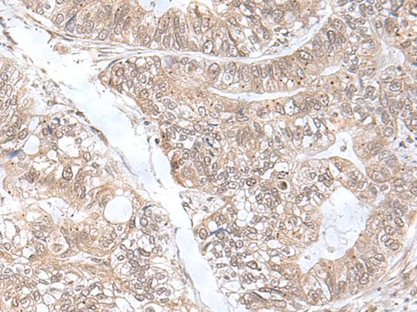 SNRNP25 Antibody