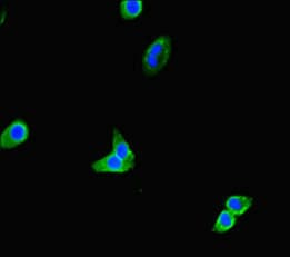 Polyclonal Rabbit anti-Human TNRC9 / TOX3 Antibody (IHC, IF, WB)