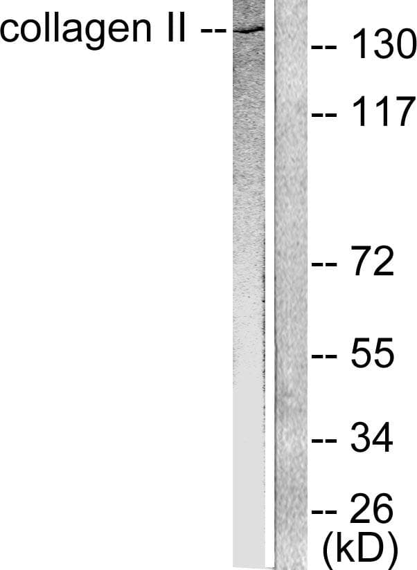 Collagen II Antibody