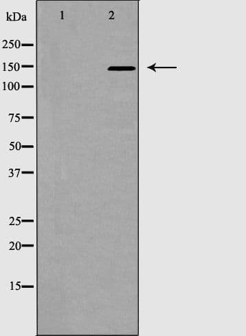 ACE / CD143 Antibody