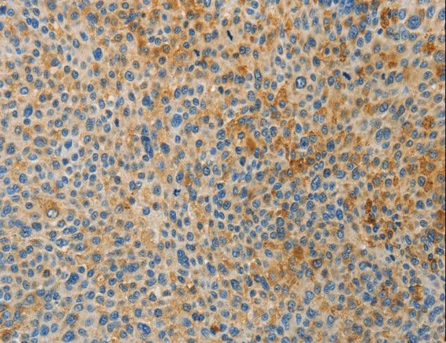 BAAT / BAT Antibody