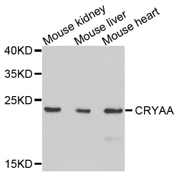 CRYAA / Alpha A Crystallin Antibody