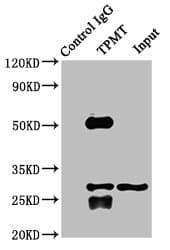IHC-plus™ Polyclonal Rabbit anti-Human TPMT Antibody (IHC, WB)