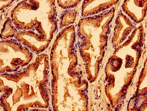 WNK2 Antibody
