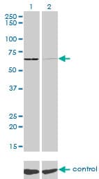 SARS / Serine-tRNA Ligase Antibody (clone 1H4)