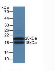 IL3RA / CD123 Antibody (aa167-331)