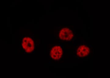 STK36 Antibody