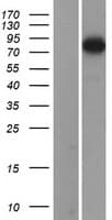 ADD3 Protein (Over-Expression Lysate Myc-DDK (Flag))