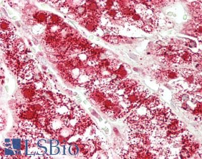 IHC-plus™ GLA / Alpha Galactosidase Antibody (aa147-371)