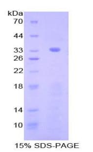 Mouse NXN Protein (Recombinant His-T7)