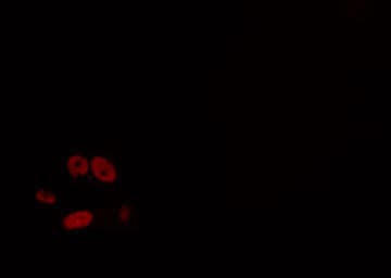 GTF3C2 Antibody