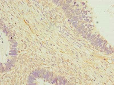 OTUD6B Antibody