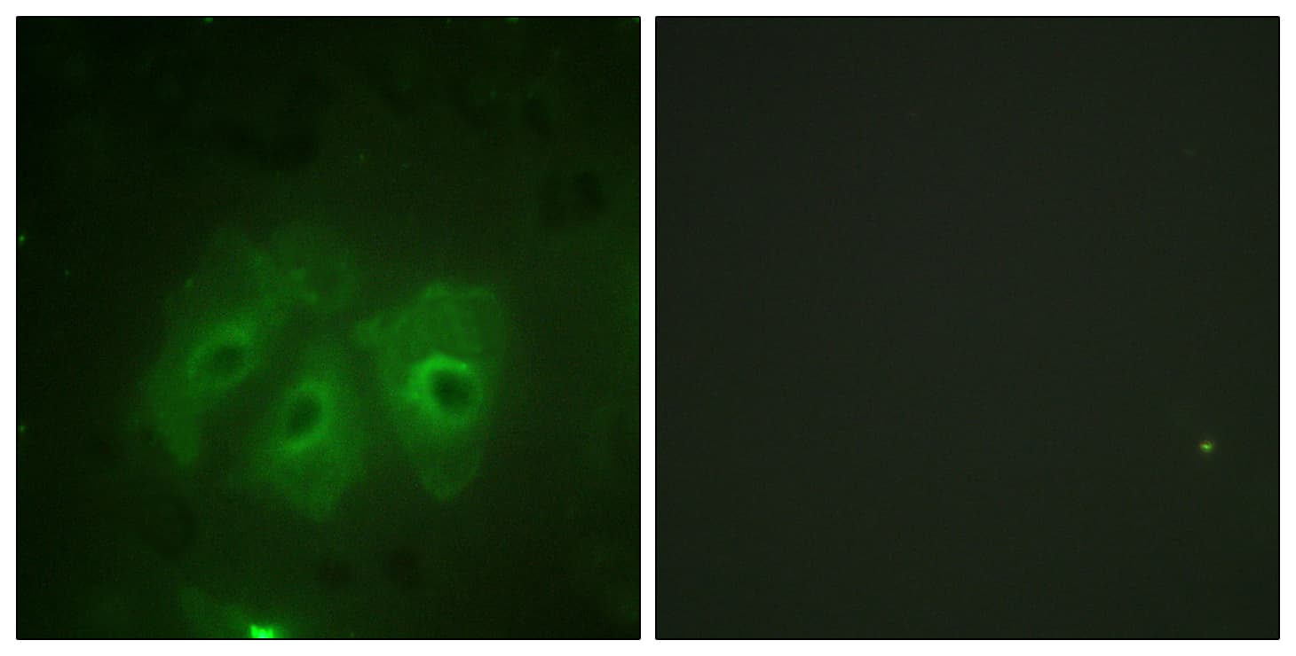 Polyclonal Rabbit anti-Human NCF1 / p47phox / p47 phox Antibody (phospho-Ser359, IHC, IF, WB)