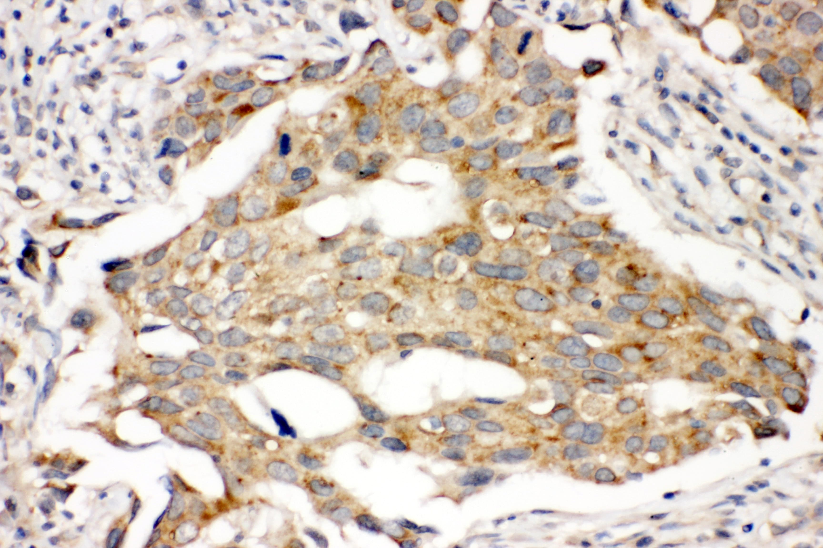 PRLR / Prolactin Receptor Antibody (aa591-605)
