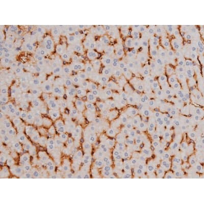 Polyclonal Rabbit anti-Human MAPT / Tau Antibody (phospho-Thr181, IHC, WB)