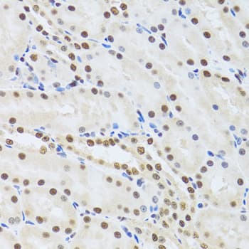 MTA3 Antibody