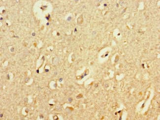 APG5 / ATG5 Antibody