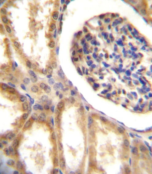 Polyclonal Rabbit anti-Human NEP / DDR1 Antibody (aa17-47, IHC, WB)