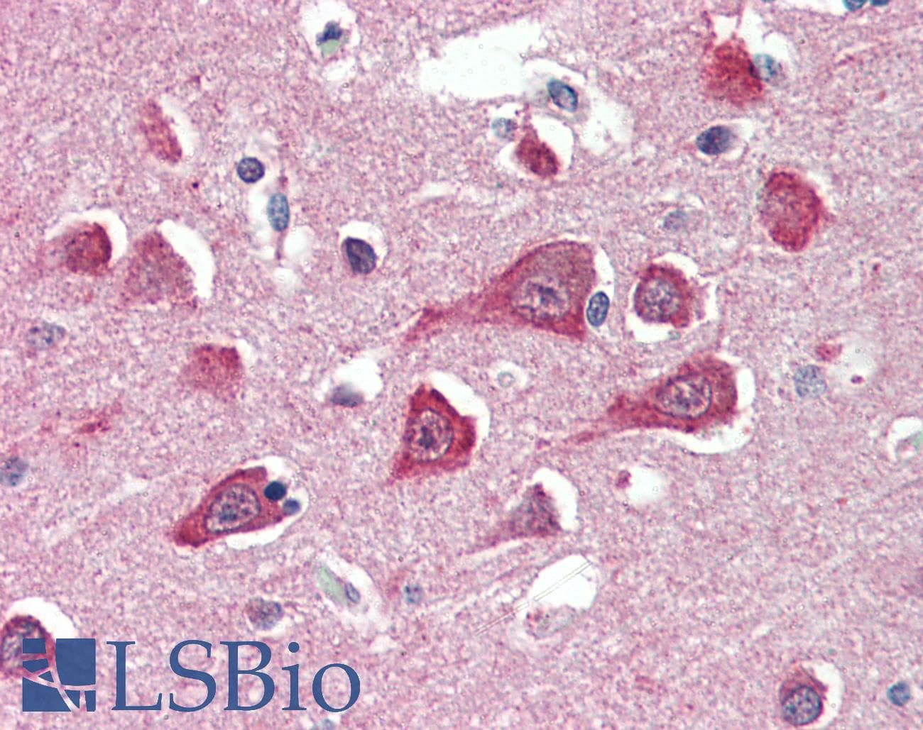 IHC-plus™ PLA2G16 / HRASLS3 Antibody (aa2-15)