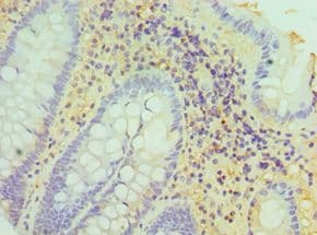 HSD17B4 Antibody (aa437-736)