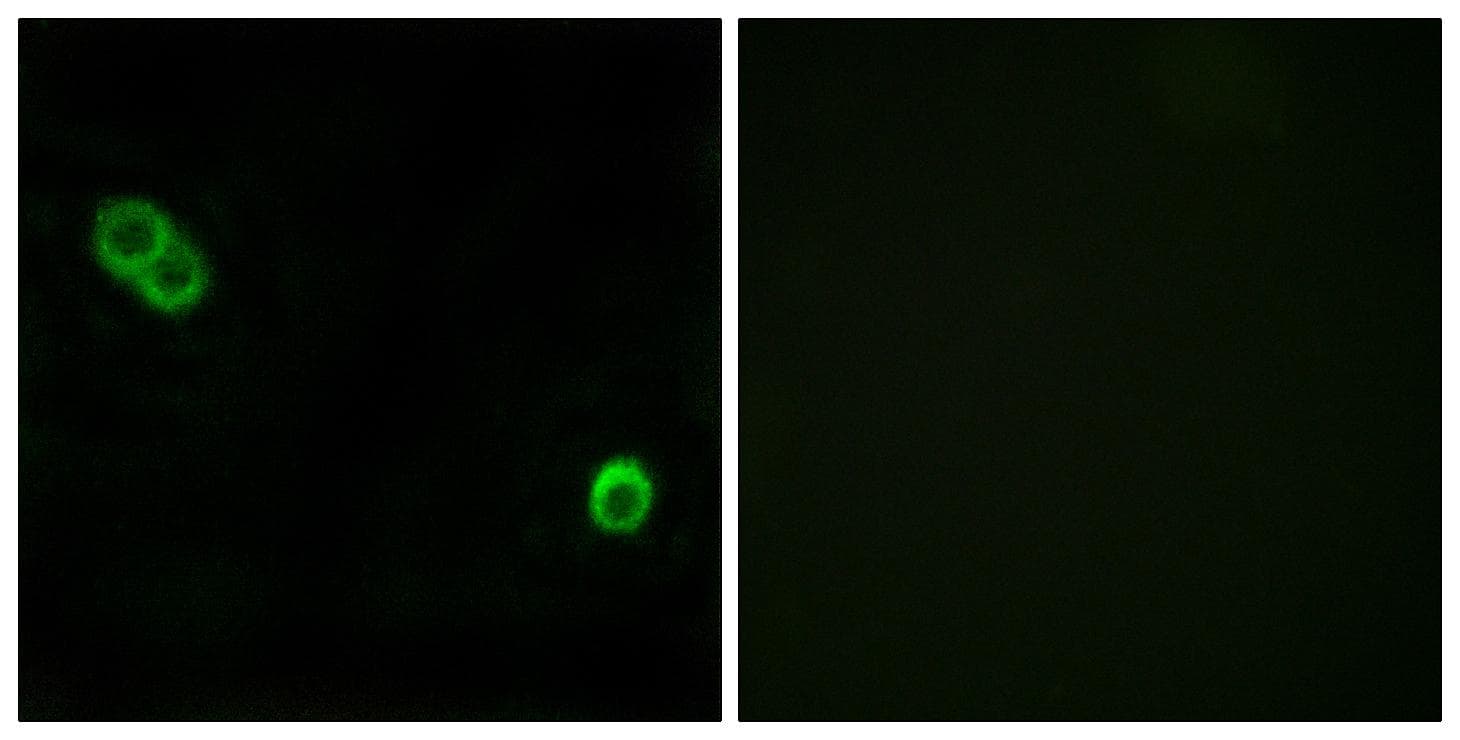 ACER3 Antibody