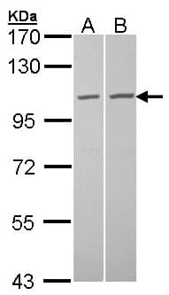 Polyclonal Rabbit anti-Human TUBGCP2 / GCP2 Antibody (aa1-226, IHC, WB)