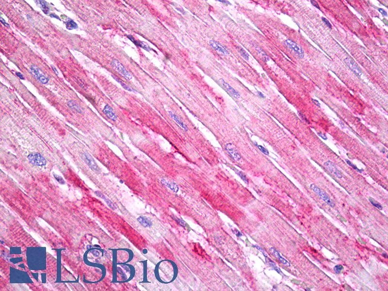 PathPlus™ LAMC1 / Laminin Gamma 1 Antibody (aa526-1106)