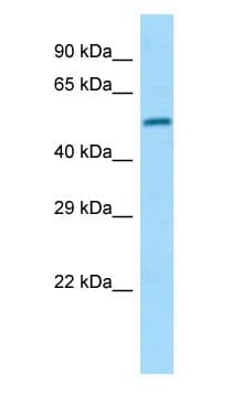Polyclonal Rabbit anti-Human DPP2 / DPP7 Antibody (aa224-273, WB)