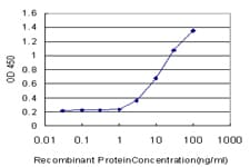 Monoclonal Mouse anti-Human NEFH / NF-H Antibody (clone 2E8, WB)