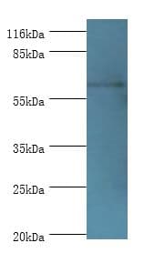 GK2 / Glycerol Kinase 2 Antibody (aa2-553)