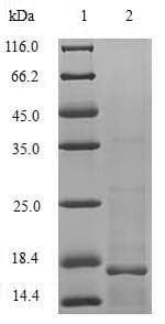 Human IL-10 Protein (Recombinant)