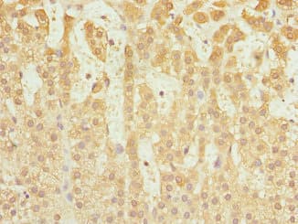 CAPNS1 / CAPN4 Antibody