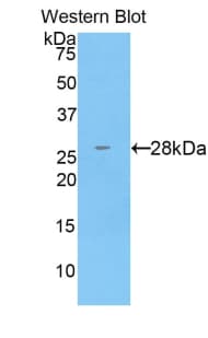 CTSC / Cathepsin C / JP Antibody (aa231-463)