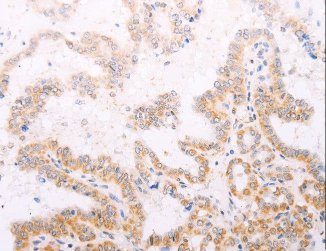 Tyrosinase Antibody