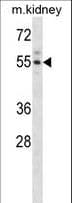 ACVR2 / ACVR2A Antibody (aa22-49)