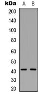 RRM2B / P53R2 Antibody (Internal)