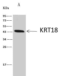KRT18 / CK18 / Cytokeratin 18 Antibody (Preservative Free)