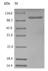 Human UBTF / UBF Protein (Recombinant 6His-SUMO, N-terminus)