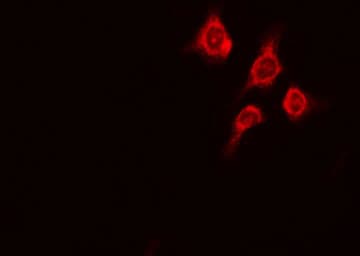 PRKD1 / PKC Mu Antibody