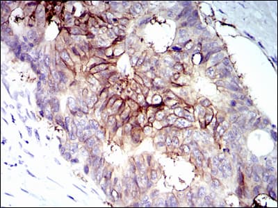 IGF1R / IGF1 Receptor Antibody (clone 3G5C1)