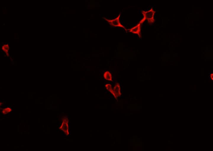 Polyclonal Rabbit anti-Human TTF / RHOH Antibody (IF, WB)