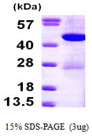 Human HPD Protein (Recombinant His)