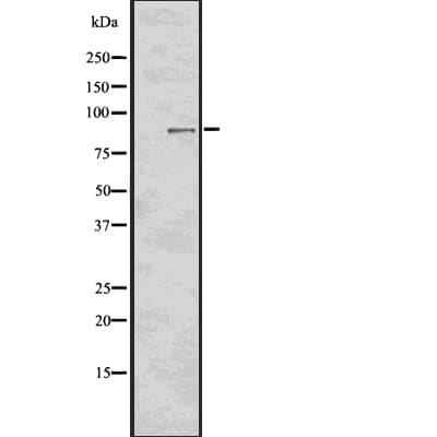 RPS6KA3 / RSK2 Antibody (phospho-Tyr529)